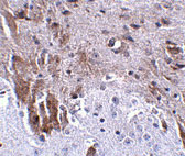 2 - LRFN1 Antibody ASC10862