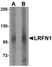 1 - LRFN1 Antibody ASC10862