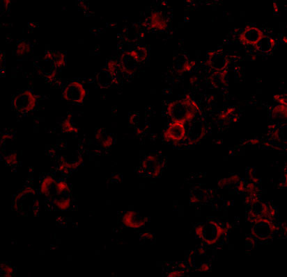 3 - LRFN2 Antibody ASC10863
