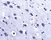 2 - LRFN2 Antibody ASC10863