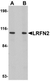 1 - LRFN2 Antibody ASC10863