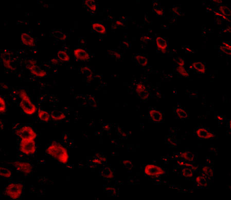 3 - LRFN3 Antibody ASC10864
