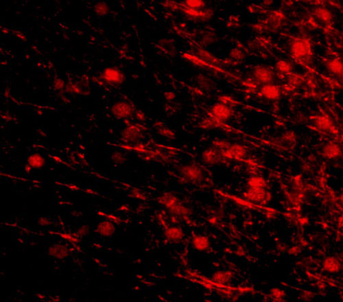 3 - LRFN4 Antibody ASC10868
