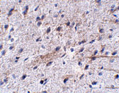 2 - LRFN5 Antibody ASC10869