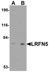 1 - LRFN5 Antibody ASC10869