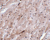 2 - CEP164 Antibody ASC10871