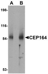 1 - CEP164 Antibody ASC10871