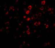 3 - Bora Antibody ASC10877