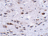 2 - Bora Antibody ASC10877