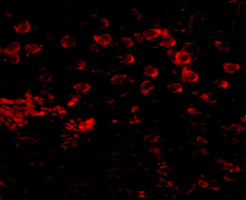 3 - MATN4 Antibody ASC10881