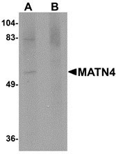 1 - MATN4 Antibody ASC10881