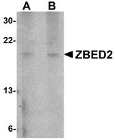 1 - ZBED2 Antibody ASC10884