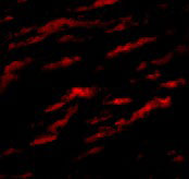 3 - MATN1 Antibody ASC10886