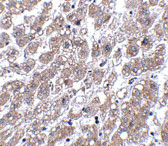 2 - MATN1 Antibody ASC10886