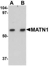 1 - MATN1 Antibody ASC10886