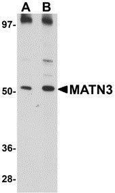 1 - MATN3 Antibody ASC10887