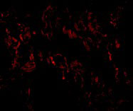 3 - TNFAIP3 Antibody ASC10889
