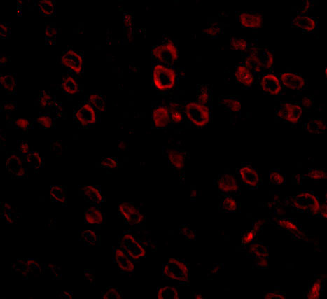 3 - FKBP15 Antibody ASC10890