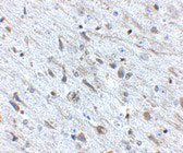 2 - FKBP15 Antibody ASC10890