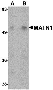 1 - MATN1 Antibody ASC10892