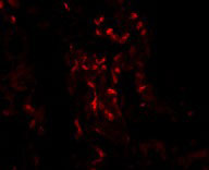 3 - TNFAIP3 Antibody ASC10895