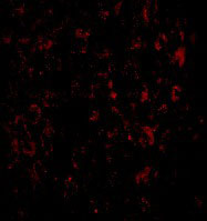 3 - MACC1 Antibody ASC10916