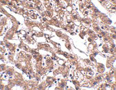2 - MACC1 Antibody ASC10916