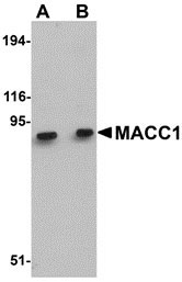 1 - MACC1 Antibody ASC10916
