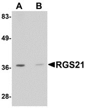 1 - RGS21 Antibody ASC10918