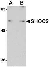 1 - SHOC2 Antibody ASC10921