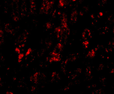 3 - AFAP1L2 Antibody ASC10924