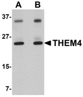 1 - THEM4 Antibody ASC10927