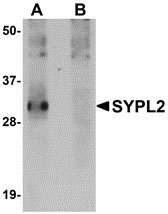 1 - SYPL2 Antibody ASC10939