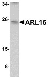 1 - ARL15 Antibody ASC10943