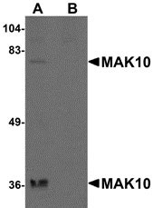 1 - MAK10 Antibody ASC10947