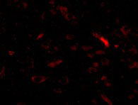 3 - GALNT10 Antibody ASC10950