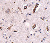2 - GALNT10 Antibody ASC10950