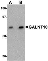 1 - GALNT10 Antibody ASC10950
