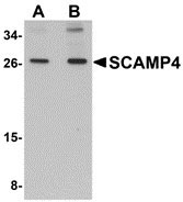1 - SCAMP4 Antibody ASC10953