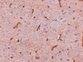 2 - TWA1 Antibody ASC10960