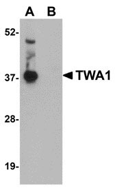 1 - TWA1 Antibody ASC10960