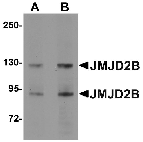1 - JMJD2B Antibody ASC10970