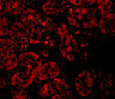3 - JMJD8 Antibody ASC10975