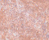 2 - JMJD8 Antibody ASC10975