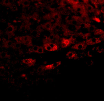 3 - Prosapip2 Antibody ASC10980