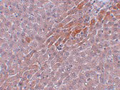 2 - Prosapip2 Antibody ASC10980