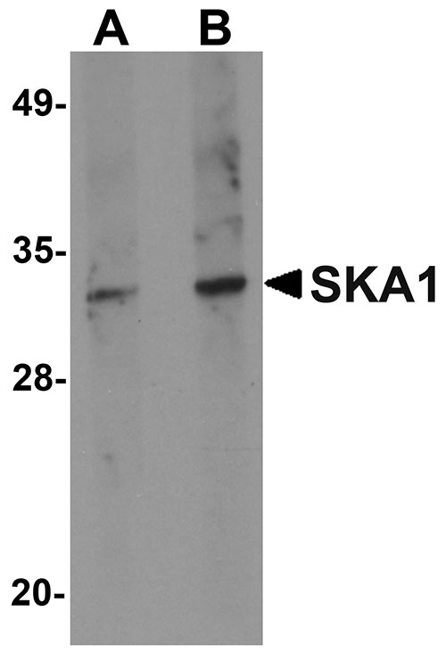 1 - SKA1 Antibody ASC10981