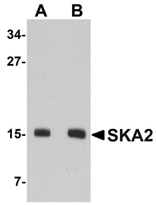 1 - SKA2 Antibody ASC10982