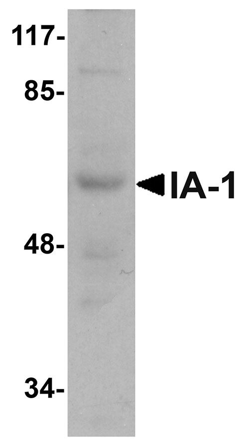 1 - IA-1 Antibody ASC10988