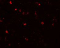 3 - TMEM16B Antibody ASC10991